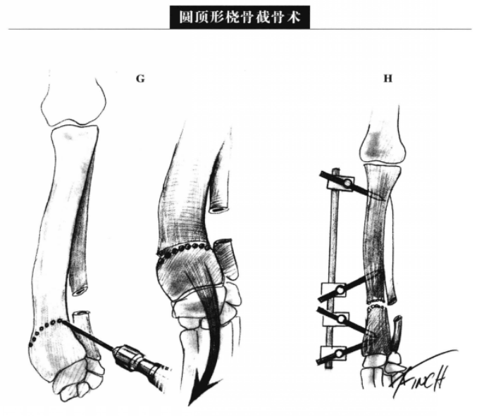 蜜桃成品人视频入口