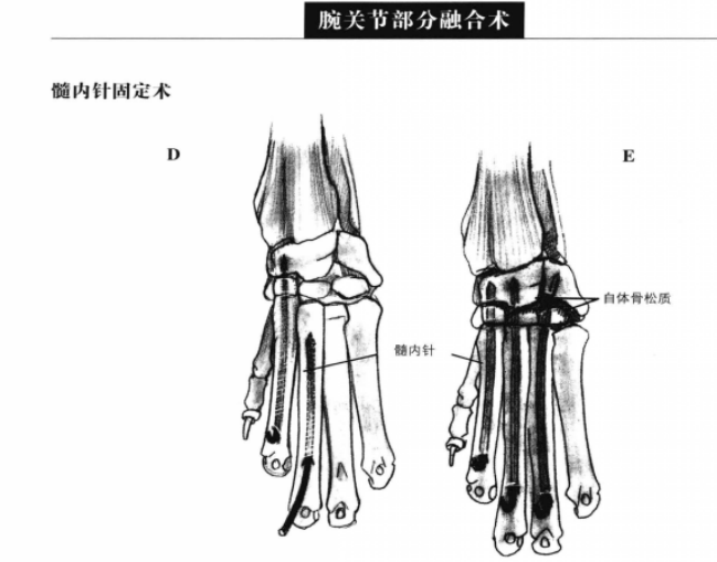 蜜桃成品人视频入口
