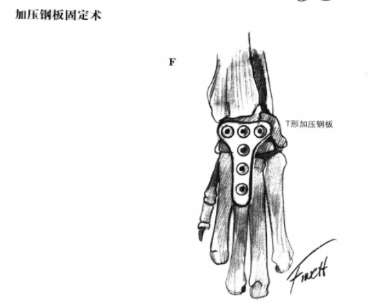 蜜桃成品人视频入口