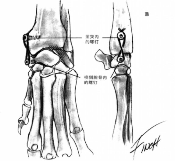 蜜桃成品人视频入口
