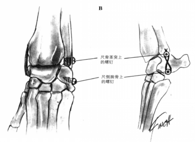 蜜桃成品人视频入口