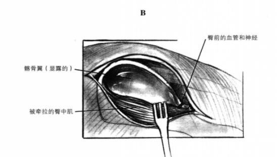 荐髂关节背侧于术通路 蜜桃成品人视频入口