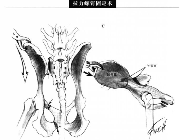 荐髂关节背侧于术通路 蜜桃成品人视频入口