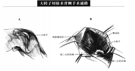 蜜桃成品人视频入口