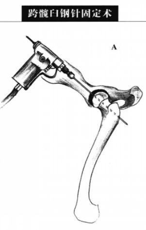 蜜桃成品人视频入口