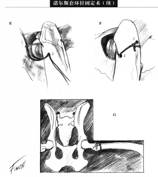 蜜桃成品人视频入口
