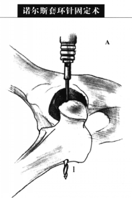 蜜桃成品人视频入口