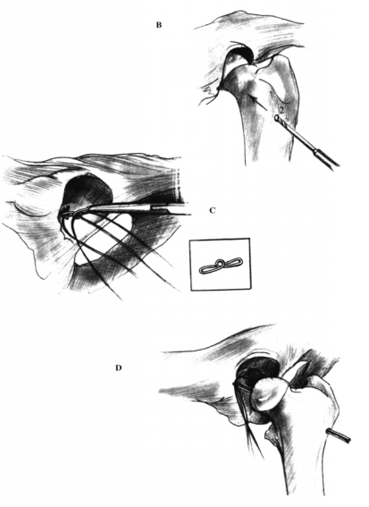 蜜桃成品人视频入口