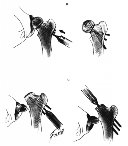 蜜桃成品人视频入口