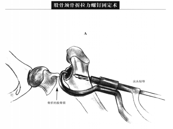 蜜桃成品人视频入口