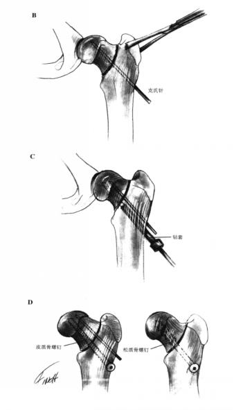 蜜桃成品人视频入口