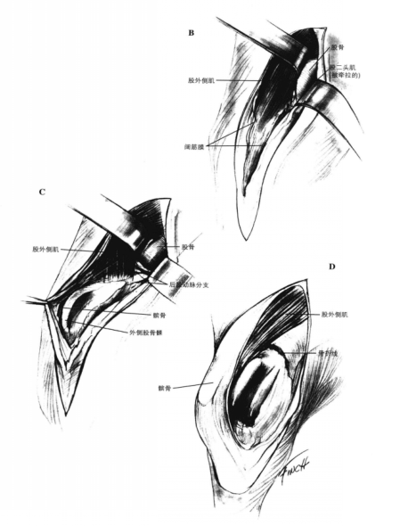 外侧手术通路 蜜桃成品人视频入口