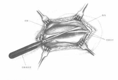 蜜桃成品人视频入口