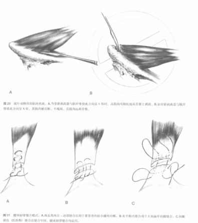 蜜桃成品人视频入口