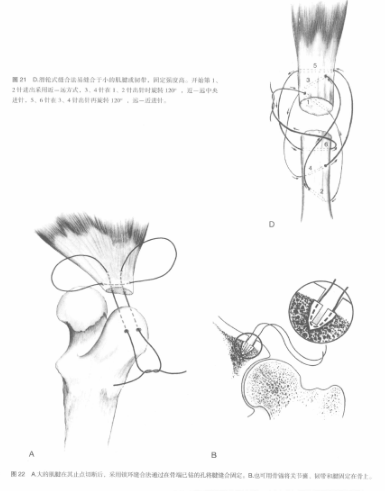 蜜桃成品人视频入口