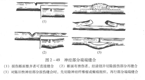 蜜桃成品人视频入口
