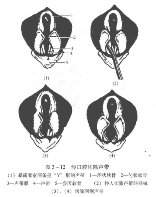 蜜桃成品人视频入口